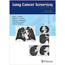 دانلود کتاب Lung Cancer Screening 1st Edition2017 غربالگری سرطان ریه