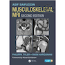دانلود کتاب Musculoskeletal MRI 2nd Edition2016 عضله اسکلتی عضلانی نسخه 2