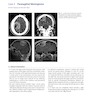 دانلود کتاب Neurosurgery Case Review: Questions and Answers 2nd Edition 2020