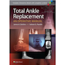 دانلود کتاب Total Ankle Replacement: An Operative Manual First Edition2014 تعویض ... 