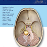 دانلود کتاب Comprehensive Management of Vestibular Schwannoma 1st Edition2019 مد ... 