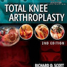دانلود کتاب Total Knee Arthroplasty, 2nd Edition2014 آرتروپلاستی کامل زانو