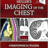 دانلود کتاب Muller’s Imaging of the Chest, 2nd Edition2018