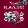 دانلود کتاب Nolte’s The Human Brain in Photographs and Diagrams, 5th Edition2019 ... 