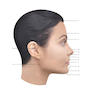 دانلود کتاب Dermal Fillers: Facial Anatomy and Injection Techniques2020