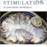 دانلود کتاب Deep Brain Stimulation: A Case-based Approach 1st Edition