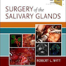 دانلود کتاب Surgery of the Salivary Glands2020 جراحی غدد بزاقی