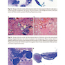 دانلود کتاب The Bethesda System for Reporting Thyroid Cytopathology, 2nd Edition ... 