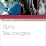 دانلود کتاب Spinal Neurosurgery (Neurosurgery by Example)2019جراحی مغز و اعصاب ن ... 