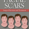 دانلود کتاب Facial Scars: Surgical Revision and Treatmentاسکارهای صورت: تجدید نظ ... 
