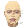 دانلود کتاب Dermal Fillers : Facial Anatomy and Injection Techniques2020