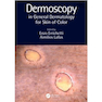 دانلود کتاب Dermoscopy in General Dermatology for Skin of Color2021