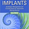 دانلود کتاب Cochlear Implants : Audiologic Management and Considerations for Imp ... 