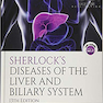 دانلود کتاب Sherlock’s Diseases of the Liver and Biliary System 13th Edition2018 ... 