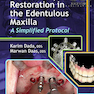 دانلود کتاب Esthetic Implant Restoration in the Edentulous Maxilla2014 ترمیم ایم ... 