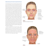 دانلود کتاب PRF in Facial EstheticsPRF