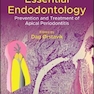دانلود کتاب ریشه دندان ضروری Essential Endodontology, 3rd Edition