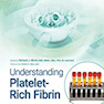 دانلود کتاب Understanding Platelet-Rich Fibrin2021