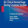 دانلود کتاب Compression Sutures for Critical Hemorrhage During Cesarean Section