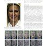دانلود کتاب Management of Post-Facial Paralysis Synkinesis