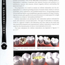 دانلود کتاب Tooth Preparations 1st Edicion 2017