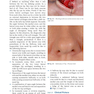 دانلود کتاب Textbook of Nasal Tip Rhinoplasty : Open Surgical Techniques