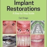 دانلود کتاب Implant Restorations : A Step-by-Step Guide