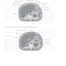 دانلود کتاب Workbook for Textbook of Diagnostic Sonography 8th Edicion