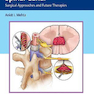 دانلود کتاب Tumors of the Spinal Canal: Surgical Approaches and Future Therapies ... 