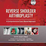 دانلود کتاب Reverse Shoulder Arthroplasty : A Comprehensive Case-Based Approach
