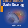 دانلود کتاب Clinical Atlas of Ocular Oncology