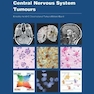 دانلود کتاب Central Nervous System Tumours (WHO Classification of Tumours) 5th E ... 