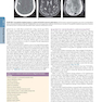 دانلود کتاب HARRISONS PRINCIPLES OF INTERNAL MEDICINE Part Neurologic Disorders