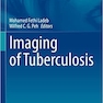 دانلود کتاب Imaging of Tuberculosis