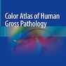 دانلود کتاب Color Atlas of Human Gross Pathology