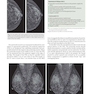 دانلود کتاب Breast Imaging : The Core Requisites 4th Edition