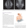 دانلود کتاب Breast Imaging : The Core Requisites 4th Edition