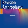 دانلود کتاب Femoral Revision Arthroplasty