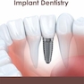 دانلود کتاب Contemporary Implant Dentistry