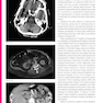 دانلود کتاب CT Anatomy for Radiotherapy2017