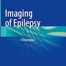 دانلود کتاب Imaging of Epilepsy: A Clinical Atlas