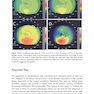 دانلود کتاب Diagnostics in Ocular Imaging: Cornea, Retina, Glaucoma and Orbit