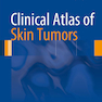 دانلود کتاب Clinical Atlas of Skin Tumors2014