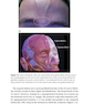 دانلود کتاب Injectable Fillers: Facial Shaping and Contouring 2nd Edition2019