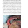دانلود کتاب Injectable Fillers: Facial Shaping and Contouring 2nd Edition2019