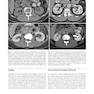 دانلود کتاب Atlas of Genitourinary Oncological Imaging