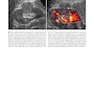 دانلود کتاب Atlas of Genitourinary Oncological Imaging