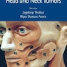 دانلود کتاب Operative Surgery for Head and Neck Tumors
