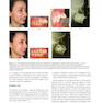 دانلود کتاب Preadjusted Edgewise Fixed Orthodontic Appliances: Principles and Pr ... 